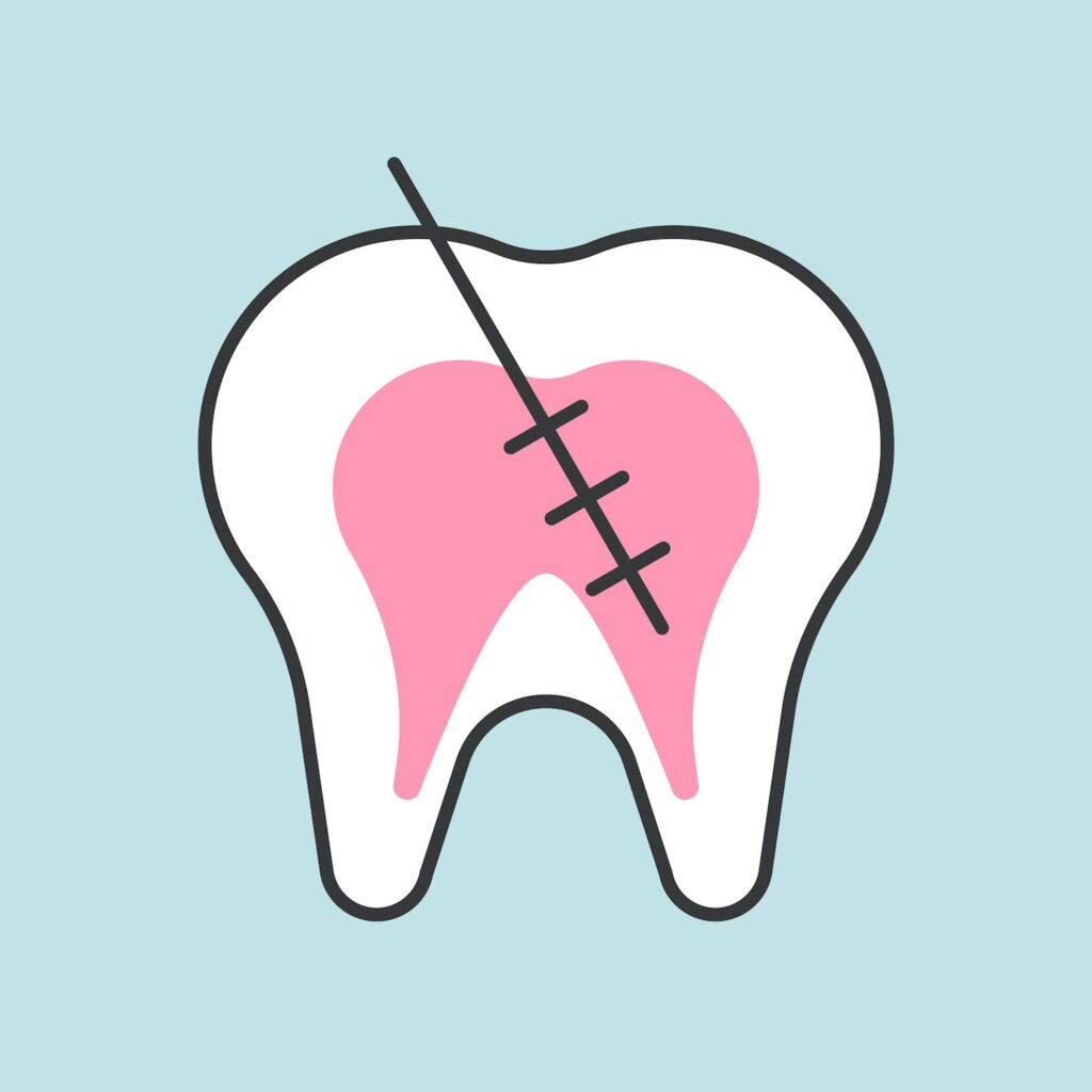 a ROOT CANAL in Davidsonville MD is nothing to be afraid of