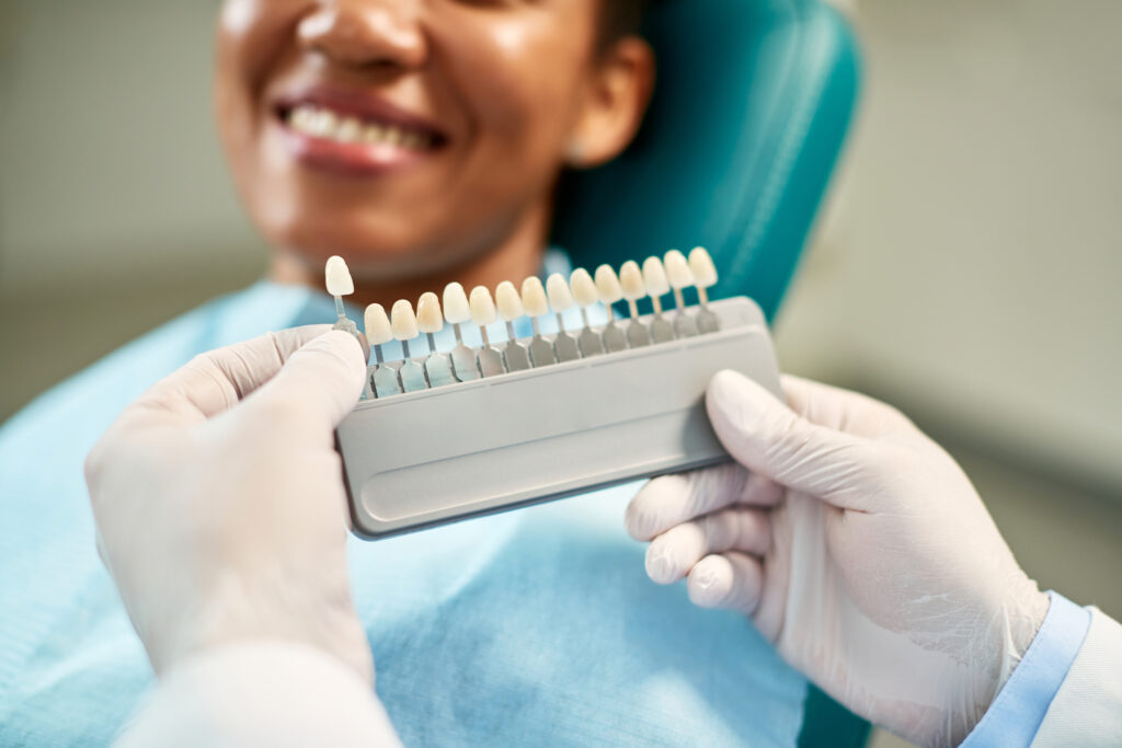 Porcelain veneers Davidsonville MD