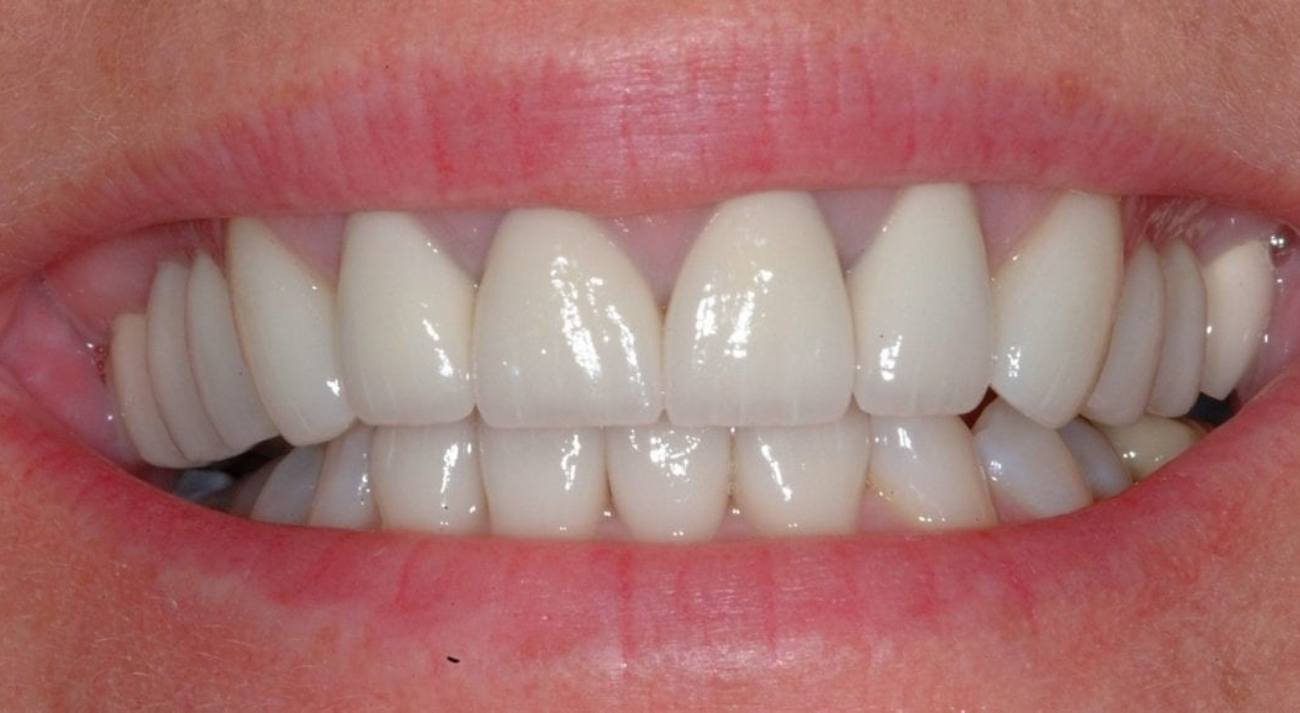 Untitled design (23)