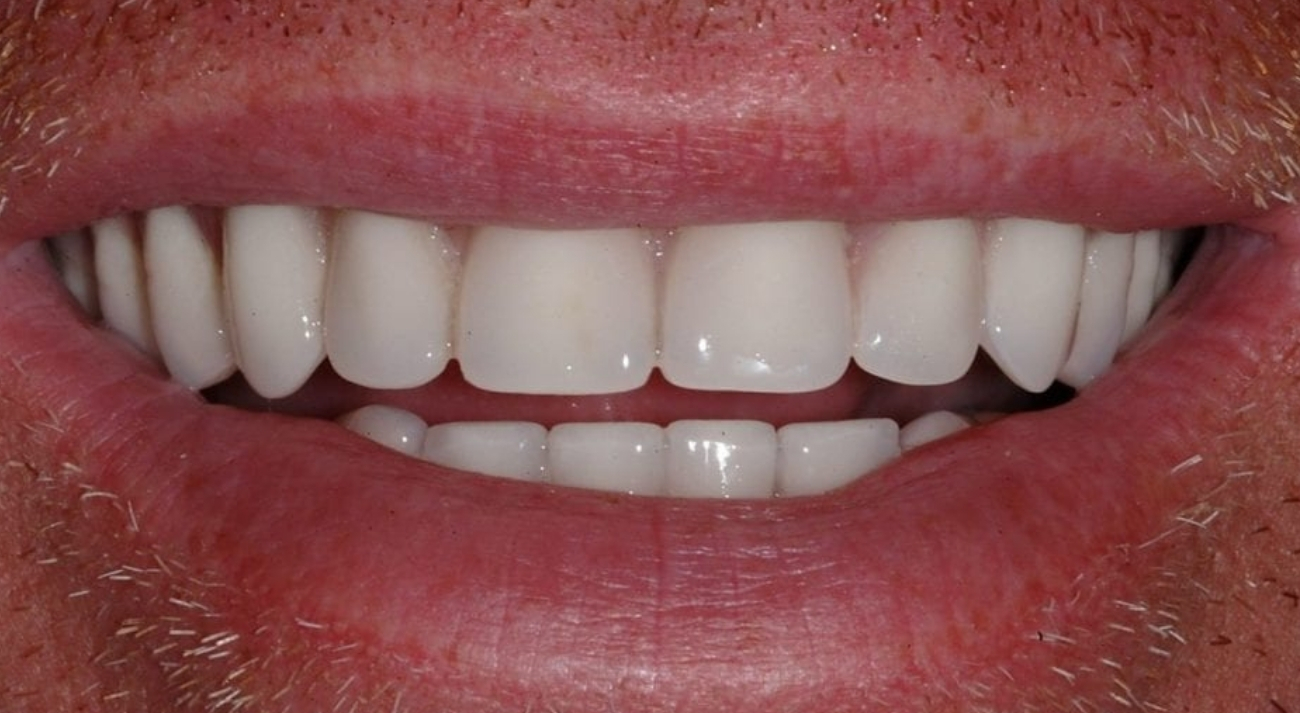 Untitled design (25)