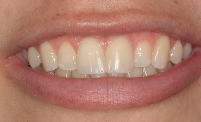 case-11-after-trauma (1)