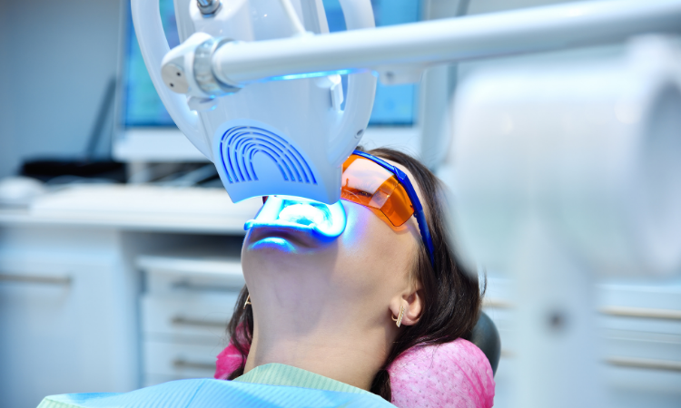 When it comes to effectiveness, safety, and lasting results, professional teeth whitening stands above the rest.